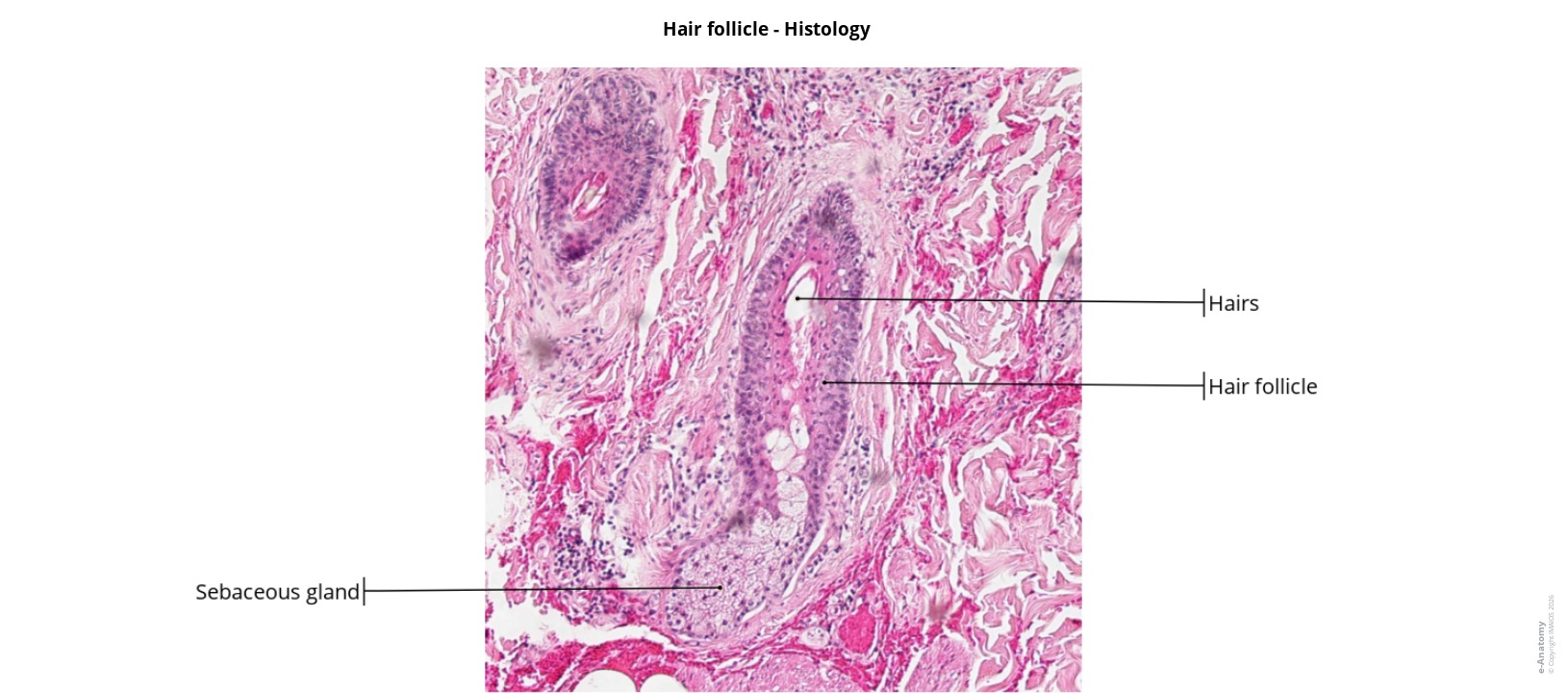 Labelled histological section of the hair follicle