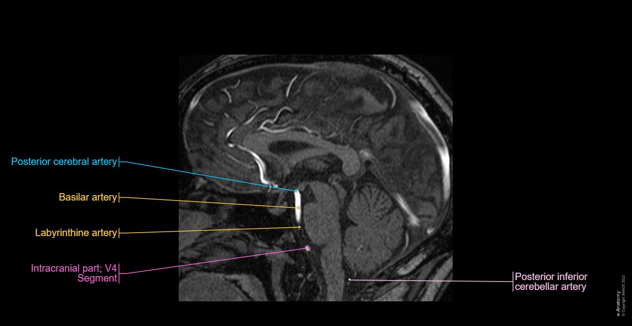 Normal neurovascular anatomy of the arteries of the brain on a Time-Of-Flight (TOF) Magnetic Resonance Angiography (MRA): Sagittal view