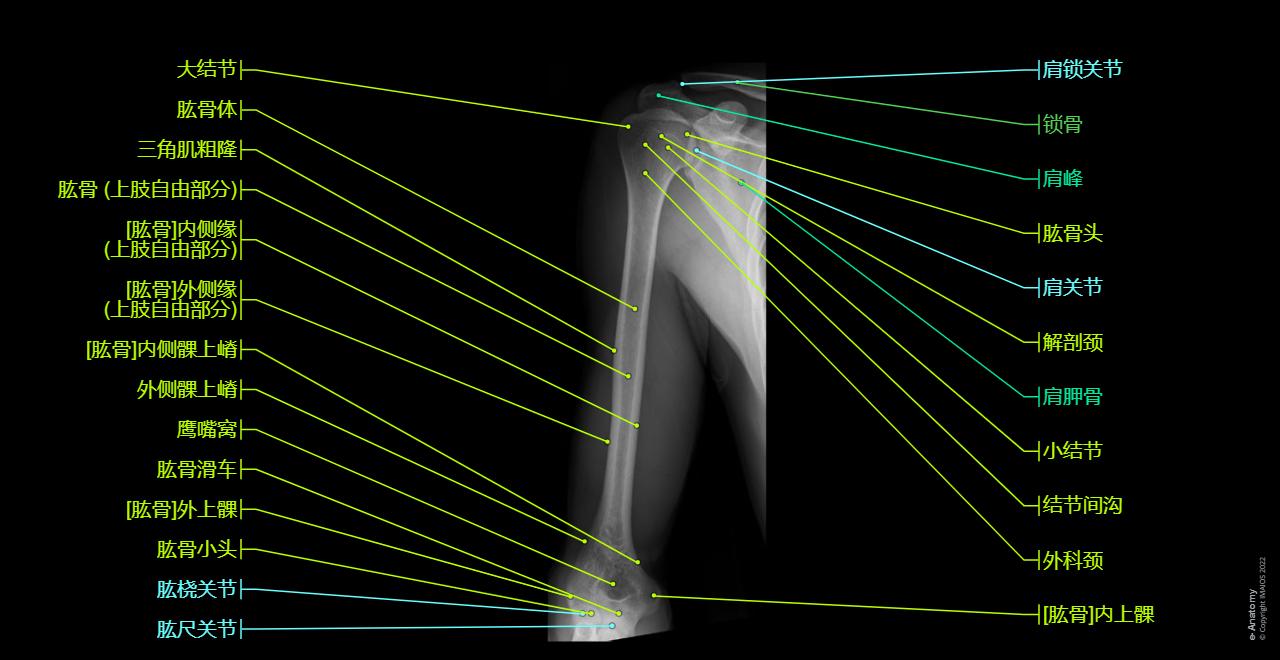 Radiographs - Arm - Humerus : Body of humerus, Surgical neck, Medial supraepicondylar ridge, Medial epicondyle, Greater tubercle, Anatomical neck
