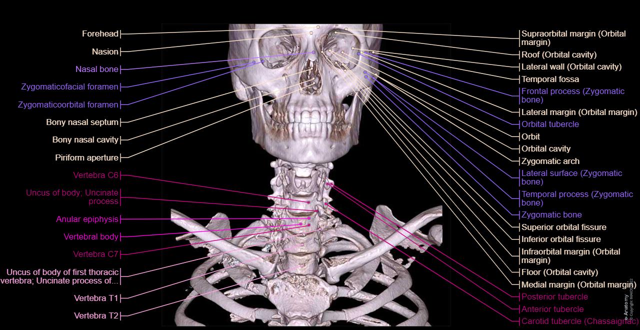 CT scan of head and neck