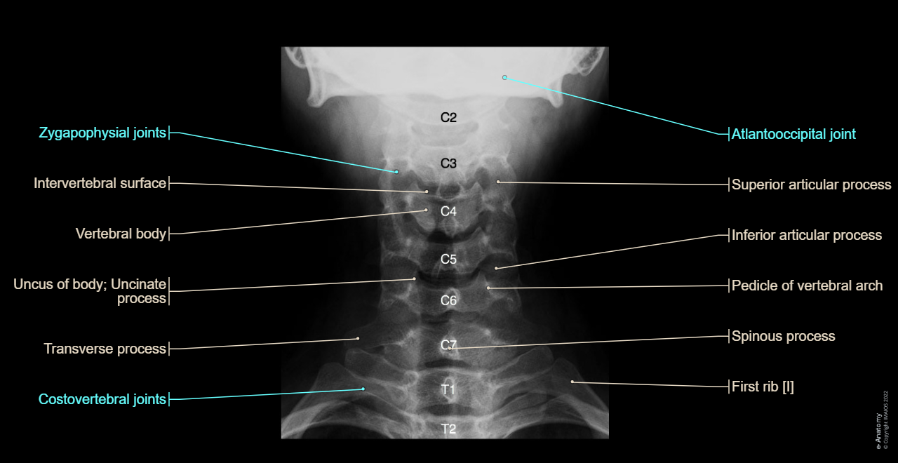 Cervical vertebrae [C I-C VII] -  - Radiographs : Zygapophysial joints, Uncus of body; Uncinate process, Transverse process, Superior articular process