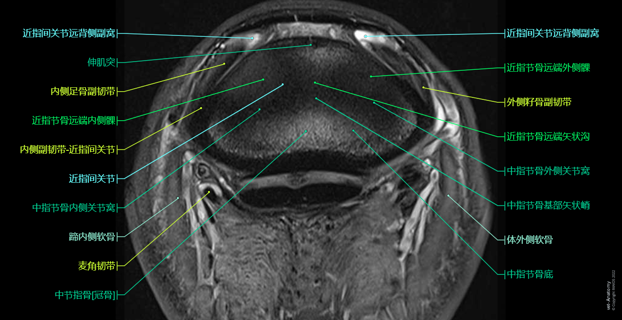 Cross-sectional labeled anatomy of the equine digit on MR imaging (hoof, foot, phalanges (long pastern bone, short pastern bone, coffin bone, distal sesamoid bone), sesamoid ligaments, Superficial digital flexor tendon (SDFT), Deep digital flexor tendon (DDFT), Common digital extensor tendon, podotrochlear bursa, proper digital artery, vein an nerve, hoof capsule)