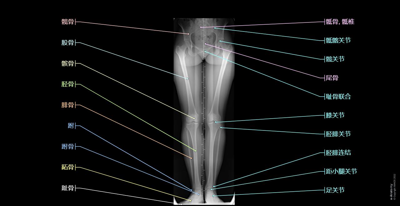 Full-length anterior-posterior weight-bearing view of the leg