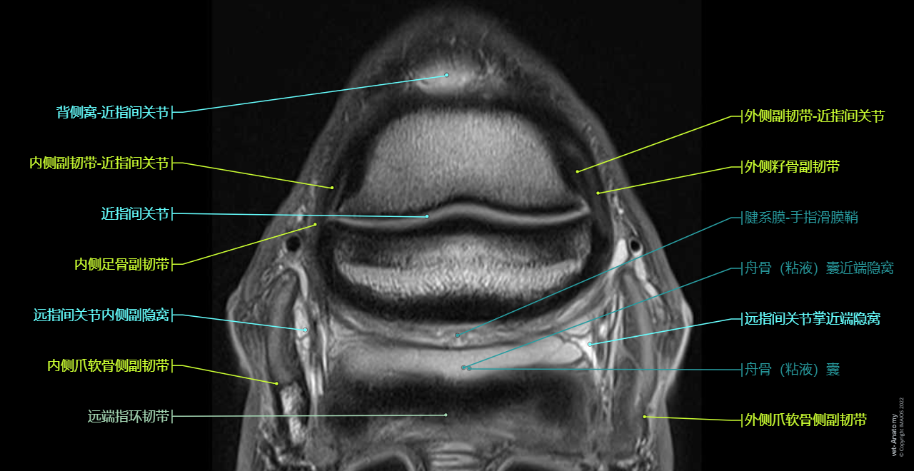 Horse - Cross-sectional anatomy (MRI - CLL PD): Lateral collateral sesamoid ligament, Medial collateral sesamoid ligament, Lateral collateral ligament - Distal interphalangeal joint [Coffin joint; DIP joint], Distal digital annular ligament