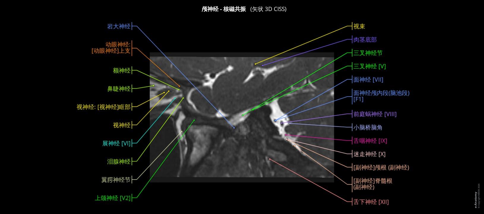 颅神经和脑干解剖:附有注释的MRI | e-Anatomy