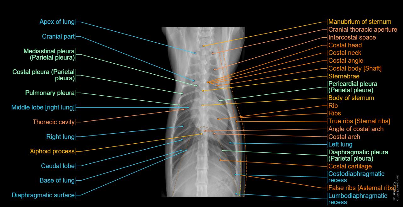 Thorax - Radiography - Ventro-dorsal