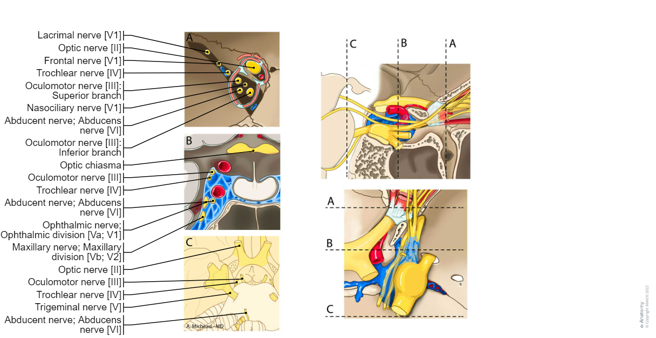Cranial nerves-Optic nerve [II]/Nerves III - IV - VI/Ophthalmic nerve; Ophthalmic division [Va; V1]: Brainstem - Cavernous sinus - Superior orbital fissure