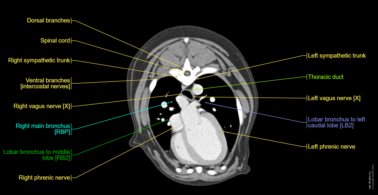 Heart - CT (Animal): Ventricle of heart, Atrium of heart, Myocardium, Right atrioventricular valve [Tricuspid valve], Left atrioventricular valve [Bicsupid valve; Mitral valve]