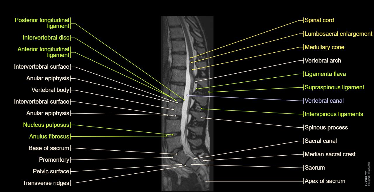 Lumbar spine anatomy on MRI (Magnetic Resonance Imaging)