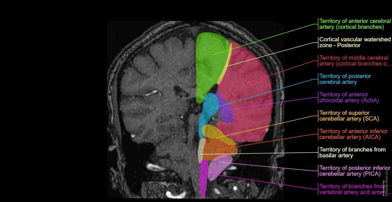Arteries of brain: Vasculary territories - Brain - MRI
