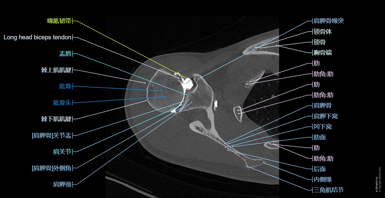 CT arthrogram of the shoulder joint : Glenoid labrum, Glenohumeral ligaments