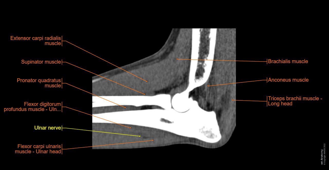 Forearm - Muscles (Dog):Cross-sectional anatomy