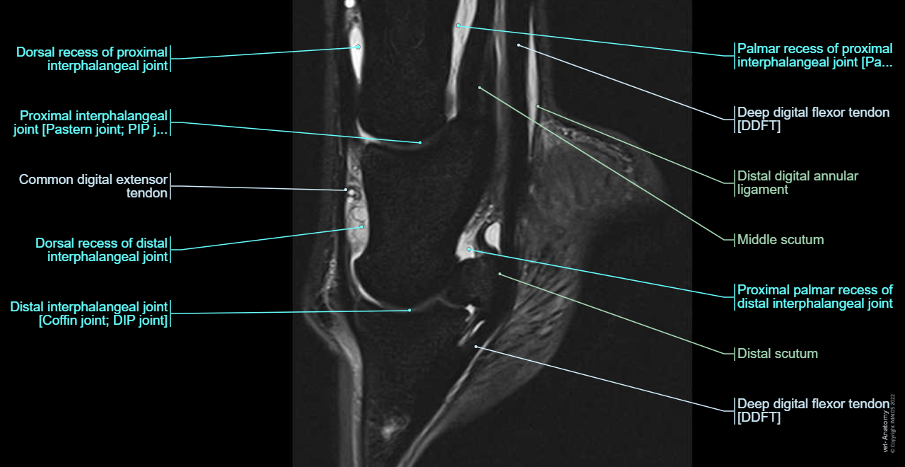 Anatomy of the equine digit on Magnetic Resonance Imaging (MRI): Superficial digital flexor tendon [SDFT], Common digital extensor tendon, Deep digital flexor tendon [DDFT], Proximal interphalangeal joint [Pastern joint; PIP joint], Distal interphalangeal joint [Coffin joint; DIP joint]