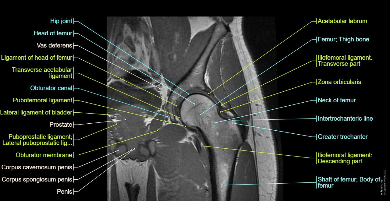 Hip anatomy: Hip joint, Iliofemoral ligament, Ligament of head of femur