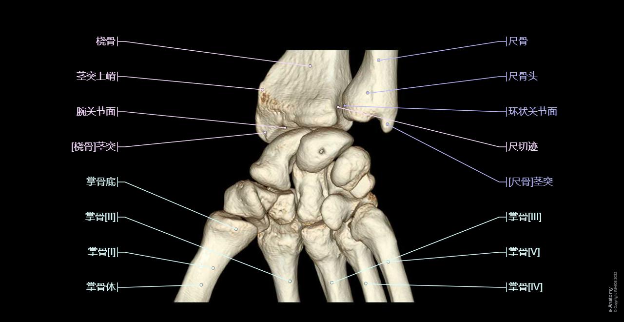 Anatomy of the wrist on 3T MR (axial, sagittal and coronal slices) and 3D views of the carpal bones : Wrist joint, Midcarpal joint, Carpometacarpal joints
