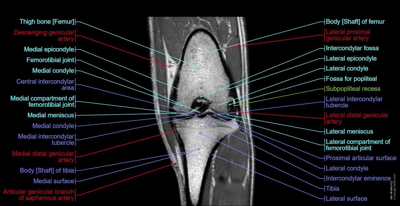 Stifle joint anatomy of the dog on MRI - Cranial cruciate ligament - Caudal cruciate ligament