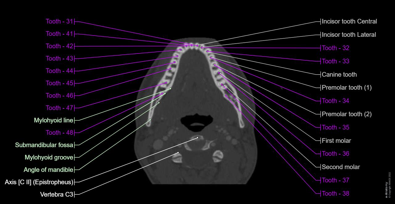 Anatomy of the maxillar and mandibular bone with teeth numbered (international tooth numbers)