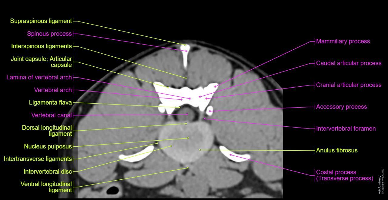Intervertebral disc - Dog (CT): Nucleus pulposus, Anulus fibrosus, Ligamenta flava,