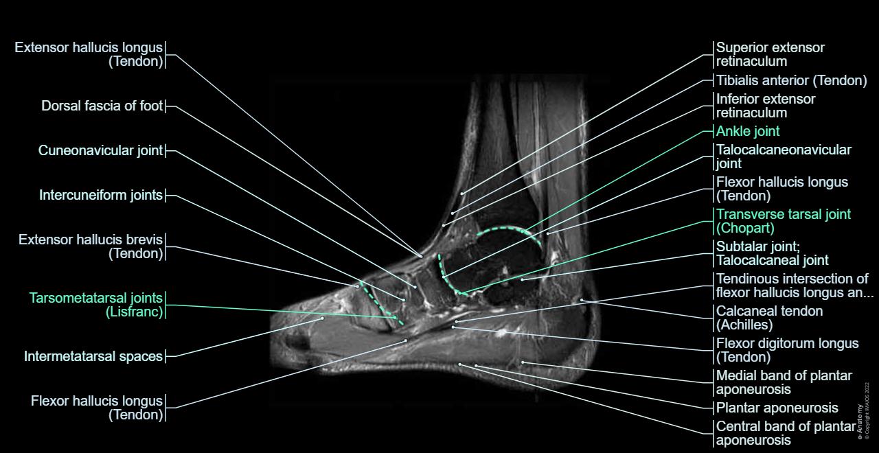 Anatomy of the whole human body : sagittal cross section of the ankle and foot based on MRI showing ankle joint, and tendos (calcaneal tendo, tibialis anterior, extensor hallucis longus and brevis, flexor digitorum longus...)