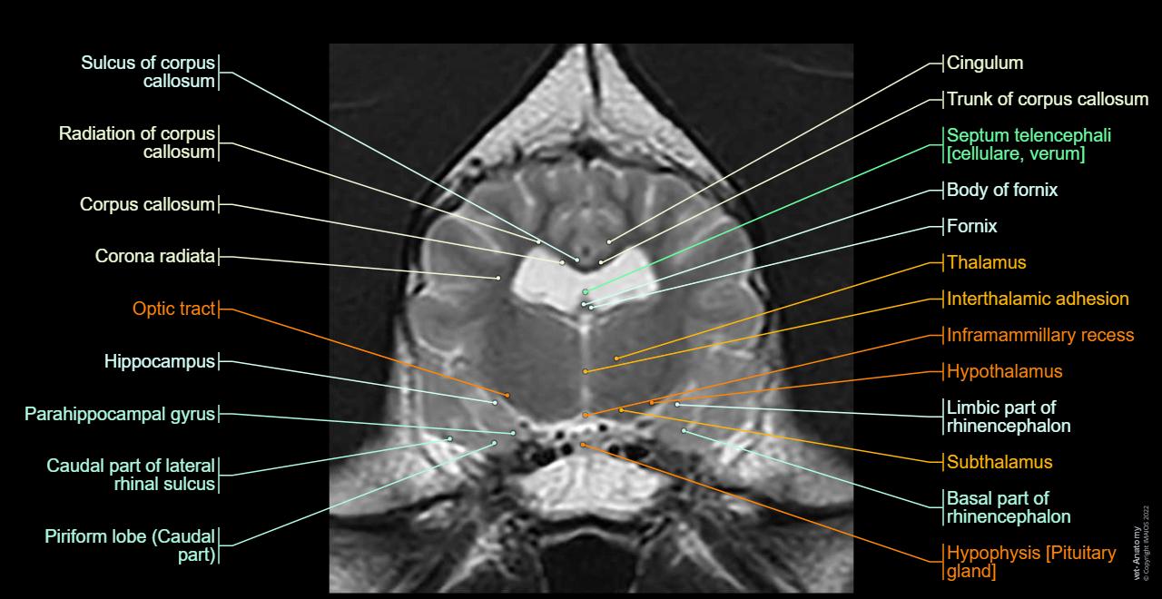 Atlas of canine brain anatomy : transverse, sagittal and dorsal sections of the dog brain on MRI
