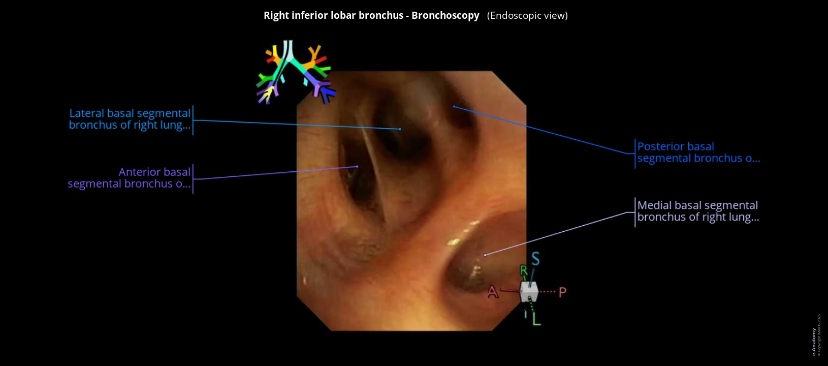 Anatomy atlas of human bronchoscopy, fully labeled