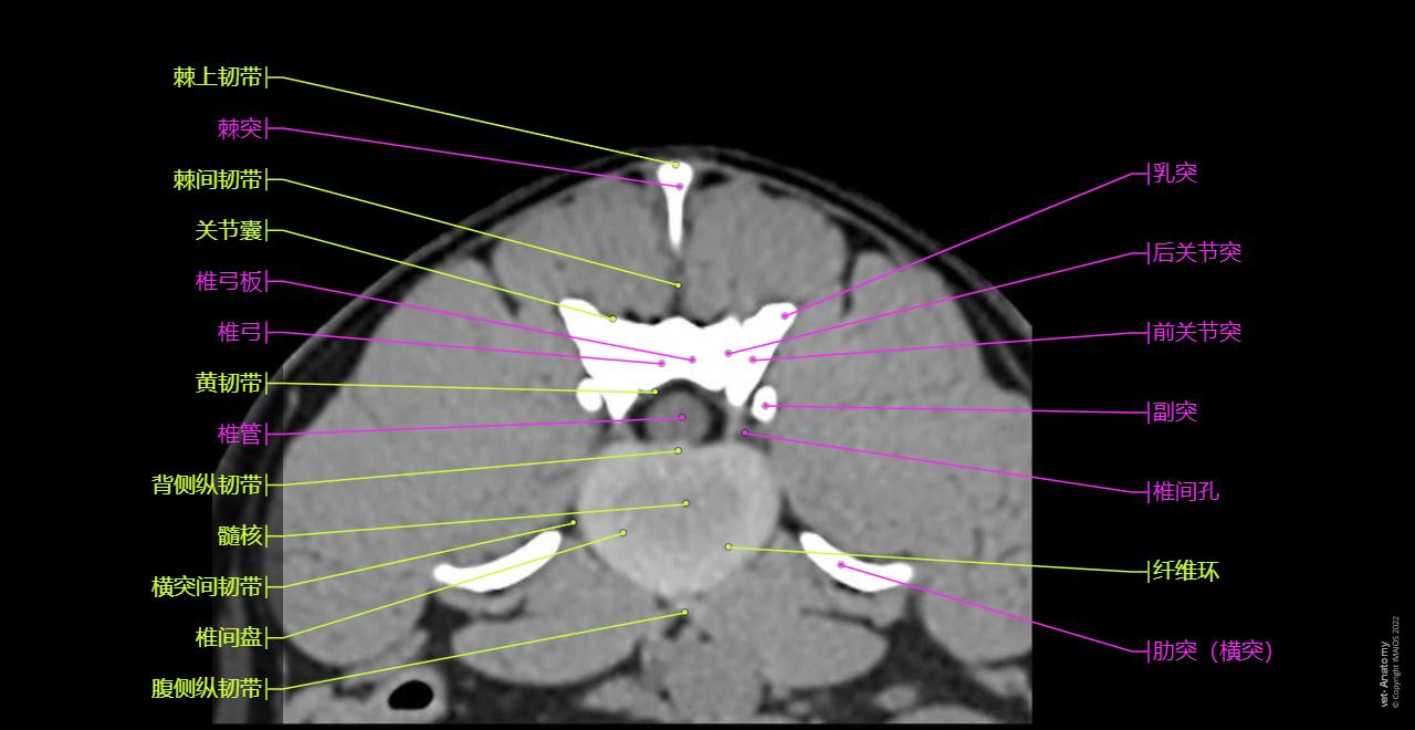 Intervertebral disc - Dog (CT): Nucleus pulposus, Anulus fibrosus, Ligamenta flava,