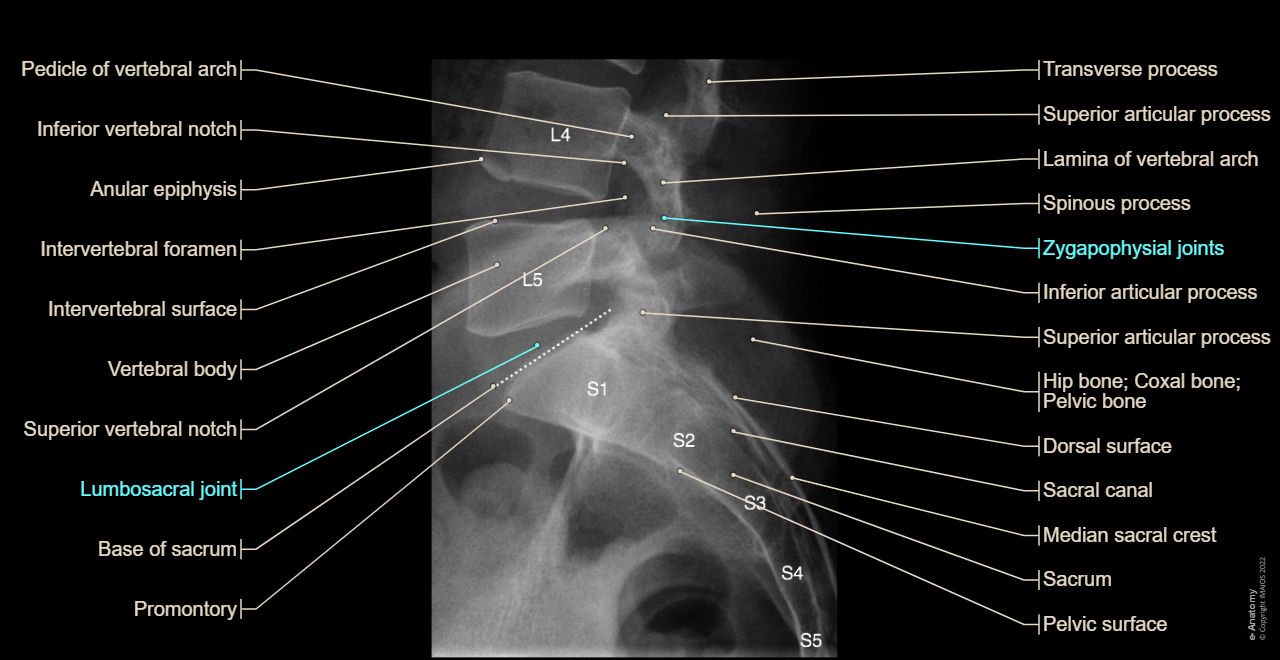 Lumbosacral joint - Anatomy - [UMLS:C1962945] : Sacrum [sacral vertebrae I - V], Sacral canal, Base of sacrum, Coccyx; coccygeal vertebrae [I-IV]