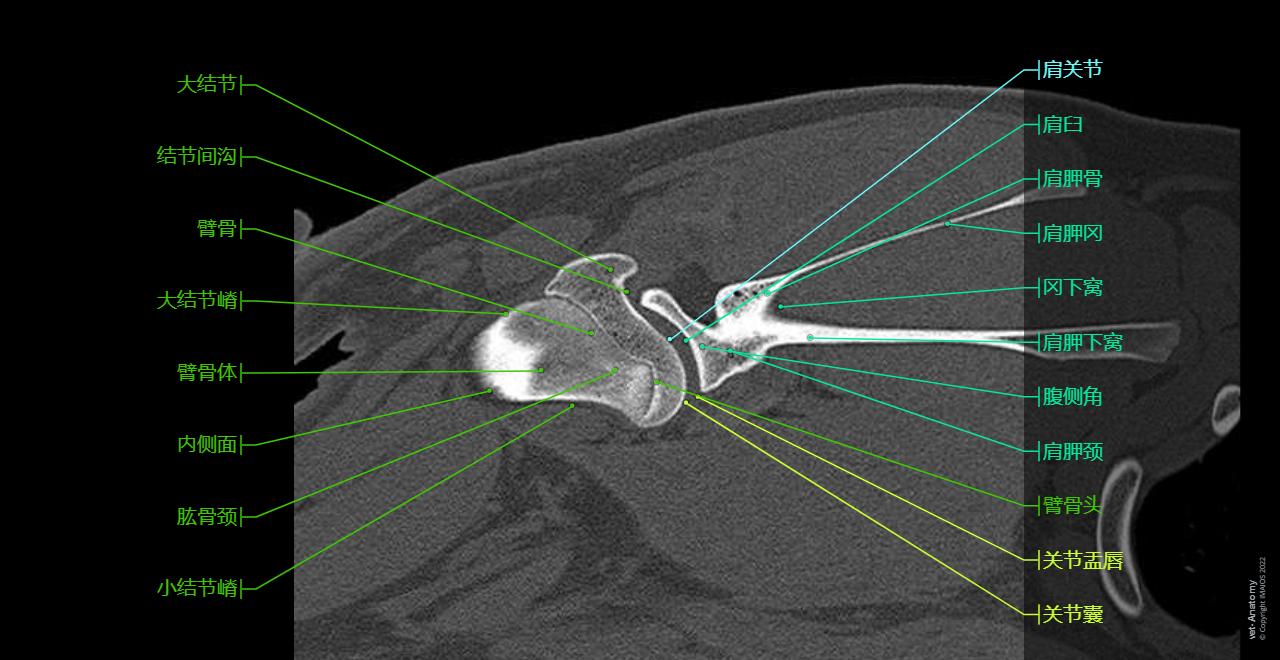 Anatomy of the shoulder joint (scapula, humerus, glenoid labrum, tendons) of the dog on CT