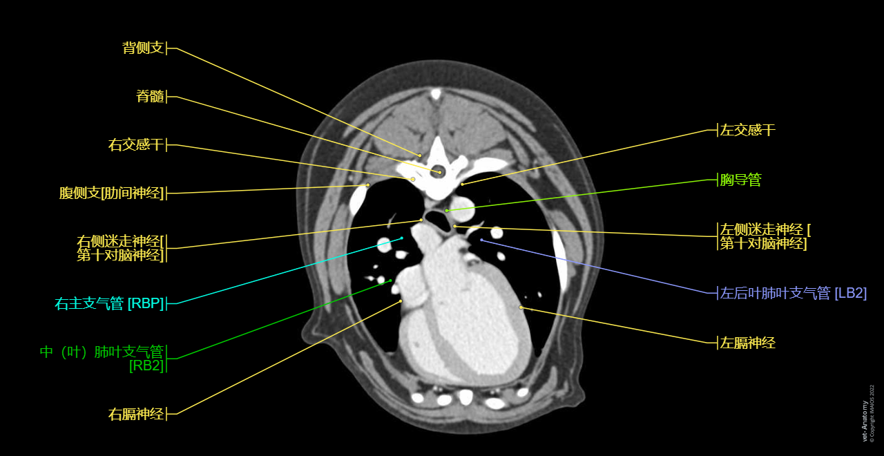 Heart - CT (Animal): Ventricle of heart, Atrium of heart, Myocardium, Right atrioventricular valve [Tricuspid valve], Left atrioventricular valve [Bicsupid valve; Mitral valve]