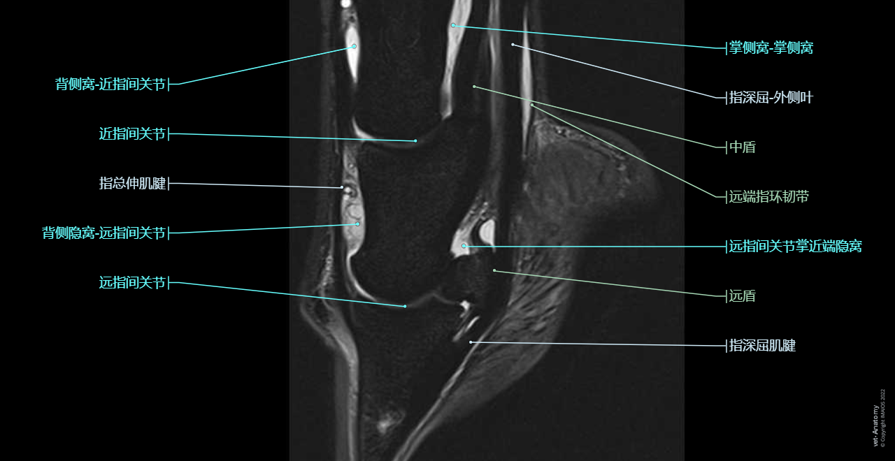 Anatomy of the equine digit on Magnetic Resonance Imaging (MRI): Superficial digital flexor tendon [SDFT], Common digital extensor tendon, Deep digital flexor tendon [DDFT], Proximal interphalangeal joint [Pastern joint; PIP joint], Distal interphalangeal joint [Coffin joint; DIP joint]
