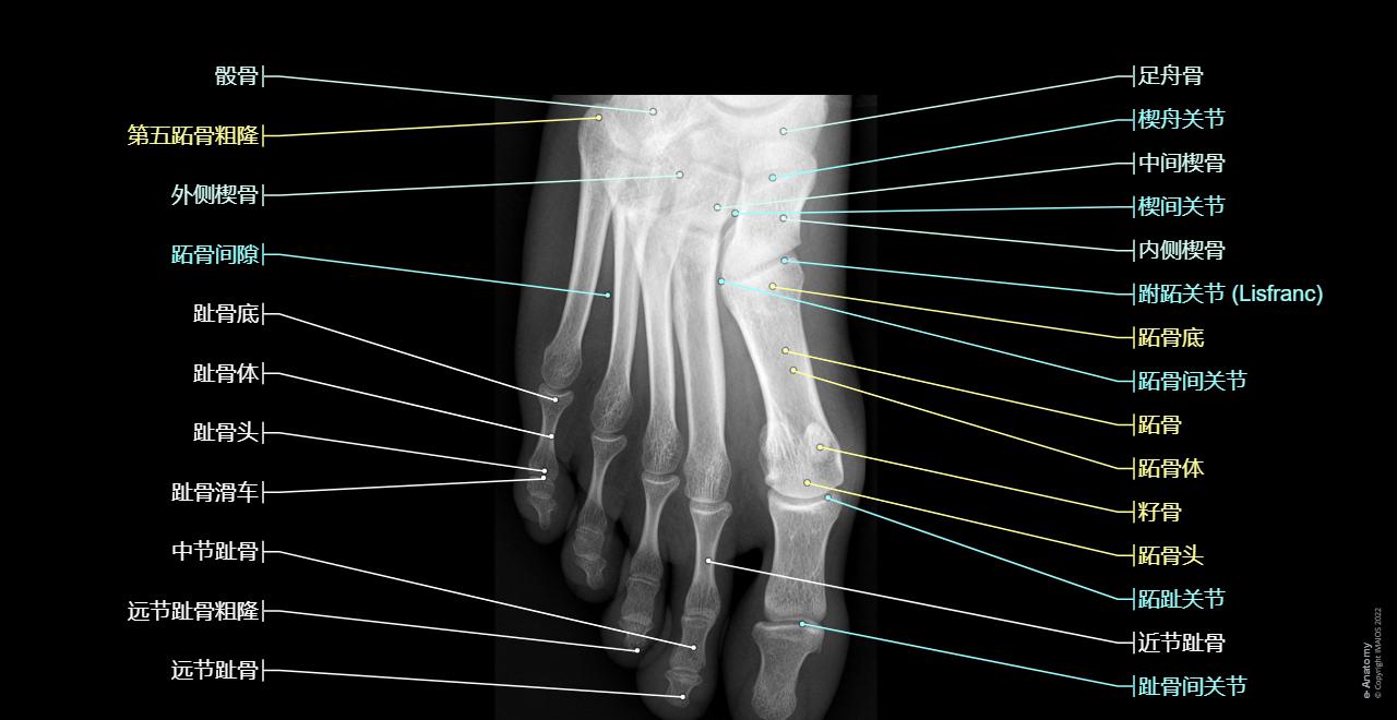 Foot - Toes : (Navicular, Medial cuneiform, Cuboid, Metatarsals, Phalanges