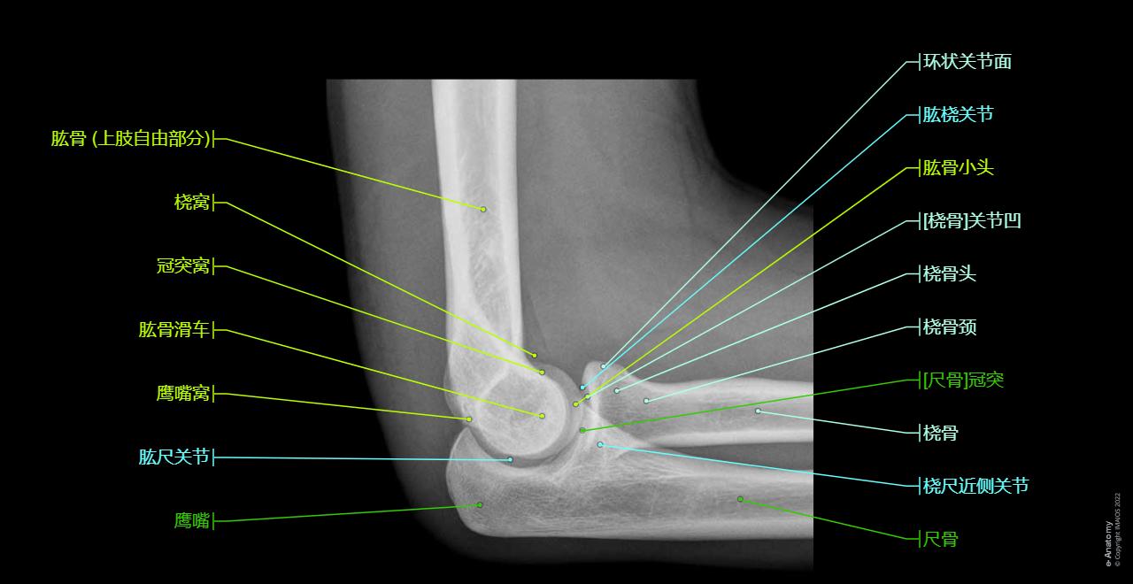 Joint - Cubital region - Radiographs - Anatomy : Humeroulnar joint, Humeroradial joint, Proximal radioulnar joint, Olecranon, Elbow, Olecranon fossa, Coronoid fossa, Radial fossa, Coronoid process