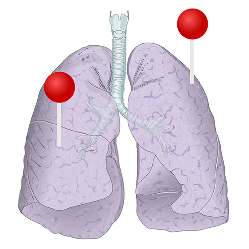 肺部 - 图解 : 正常解剖 | e-Anatomy