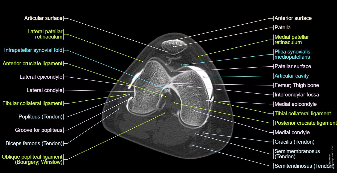 Atlas of the anatomy of the joint of the knee on a CT arthrogram in axial, coronal, and sagittal sections, on a 3D images and on conventional athrogram