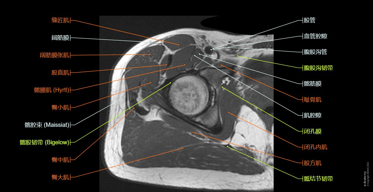 Cross sectional anatomy of the hip : axial slice of MRI with all anatomical structures labeled.