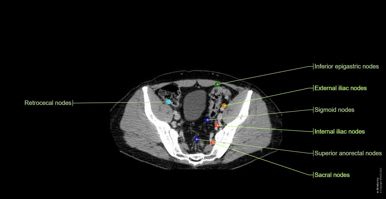 ganglions-noeud-lymphatique-pelvis-anatomie