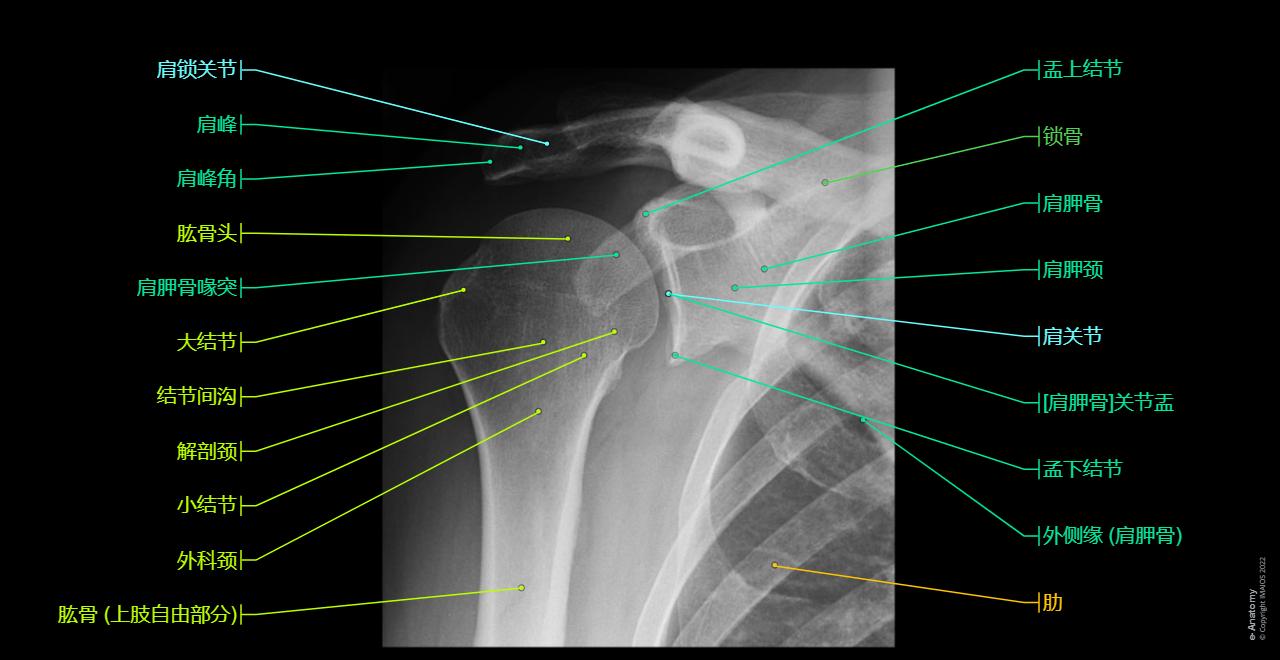 Shoulder - Pectoral girdle; Shoulder girdle - Radiographs - Human anatomy : Glenohumeral joint; Shoulder joint, Acromion, Clavicle, Scapula, Glenoid cavity, Lesser tubercle, Coracoid process