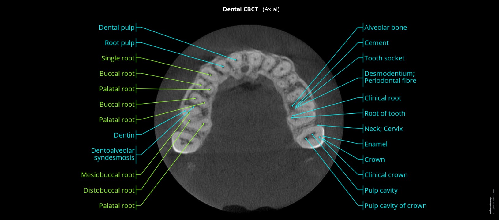 Labelled dental CBCT in humans: axial section through the dental alveoli