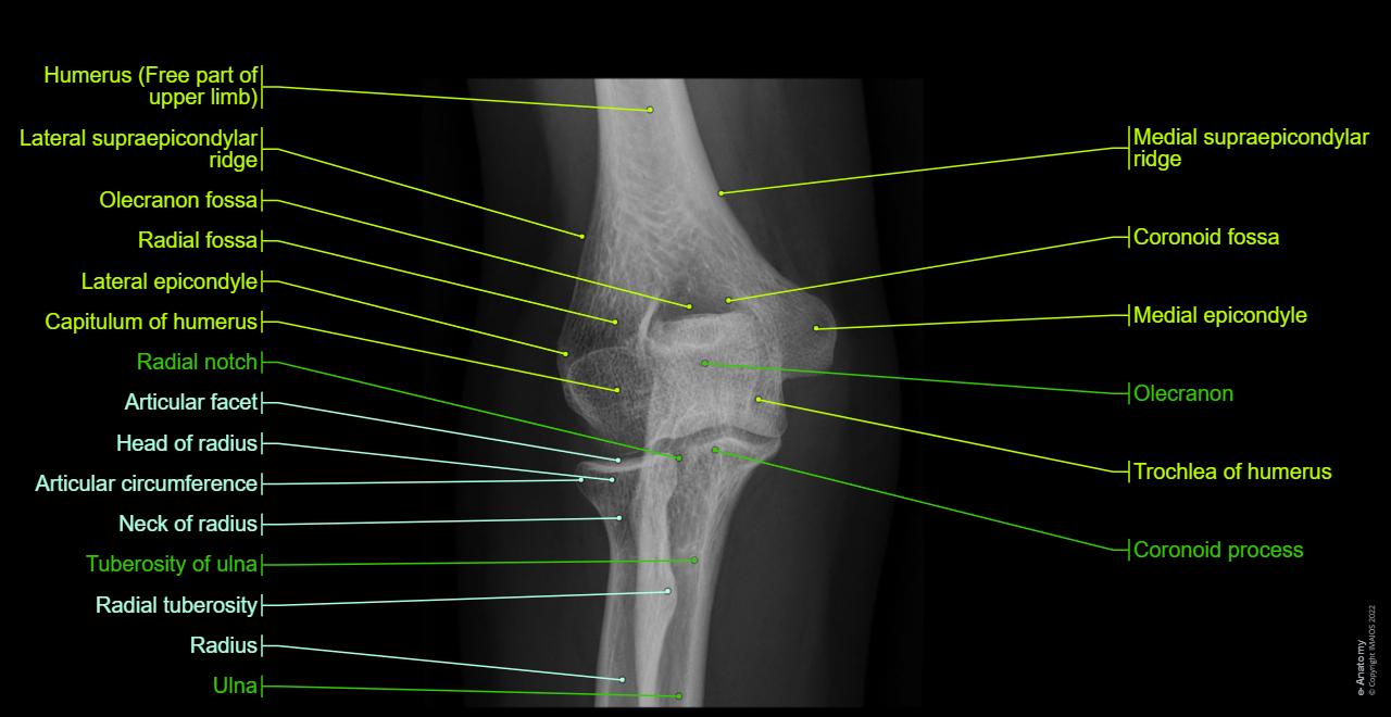 Elbow - Radiographs (Anterior-posterior view) : Lateral epicondyle, Trochlea of humerus, Coronoid process, Olecranon, Elbow joint, Humeroulnar joint, Humeroradial joint, Proximal radioulnar joint