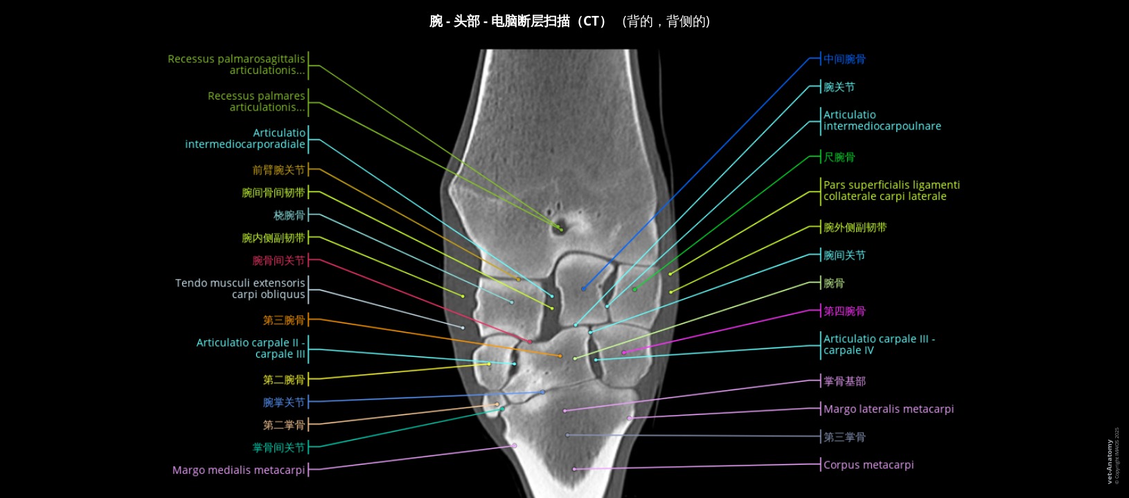 马腕关节解剖图谱