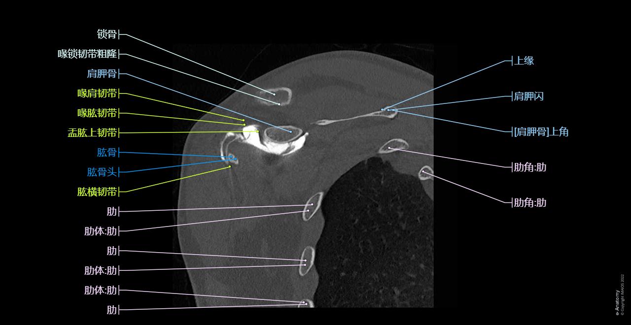 CT arthrogram of the shoulder joint : Trapezius, Deltoid