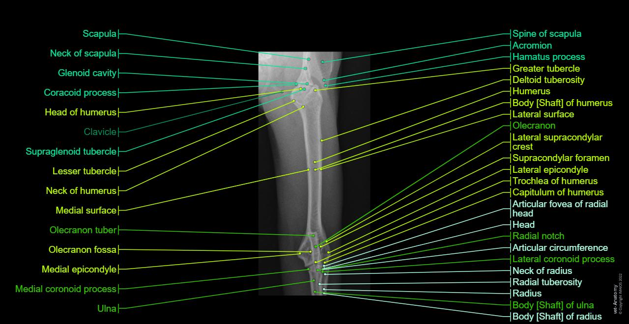 Thoracic limb - X-ray - Medio-lateral
