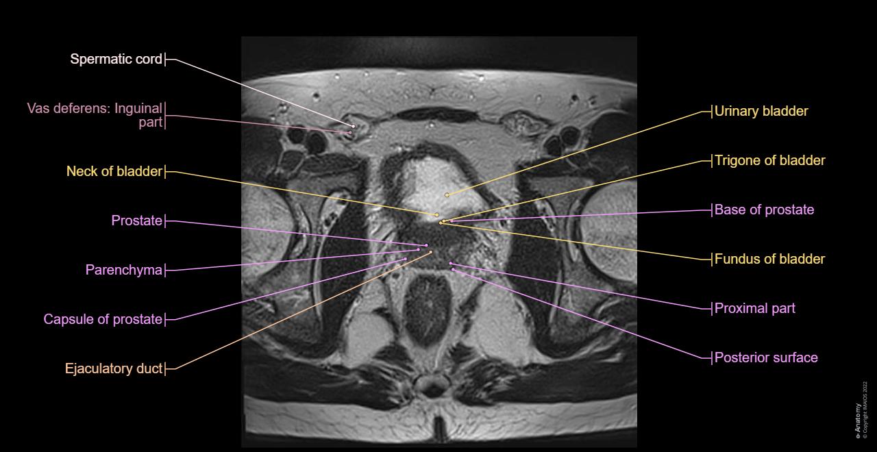 Anatomy of the male pelvis (prostate, bladder, genital organs, perineum) on MR imaging, Male pelvis, MRI, Urinary system