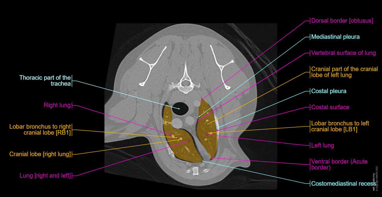 Vertebral column - CT (Labrador): Thoracic vertebrae, Vertebral body, Pedicle of vertebral arch, Spinous process