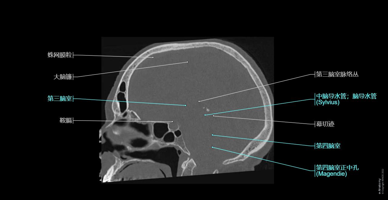 头部 CT : 正常解剖 | e-Anatomy