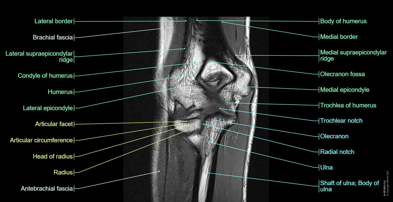 Elbow joint: Humeroulnar joint, Humeroradial joint, Proximal radioulnar joint, Ulnar collateral ligament, Radial collateral ligament, Anular ligament of radius