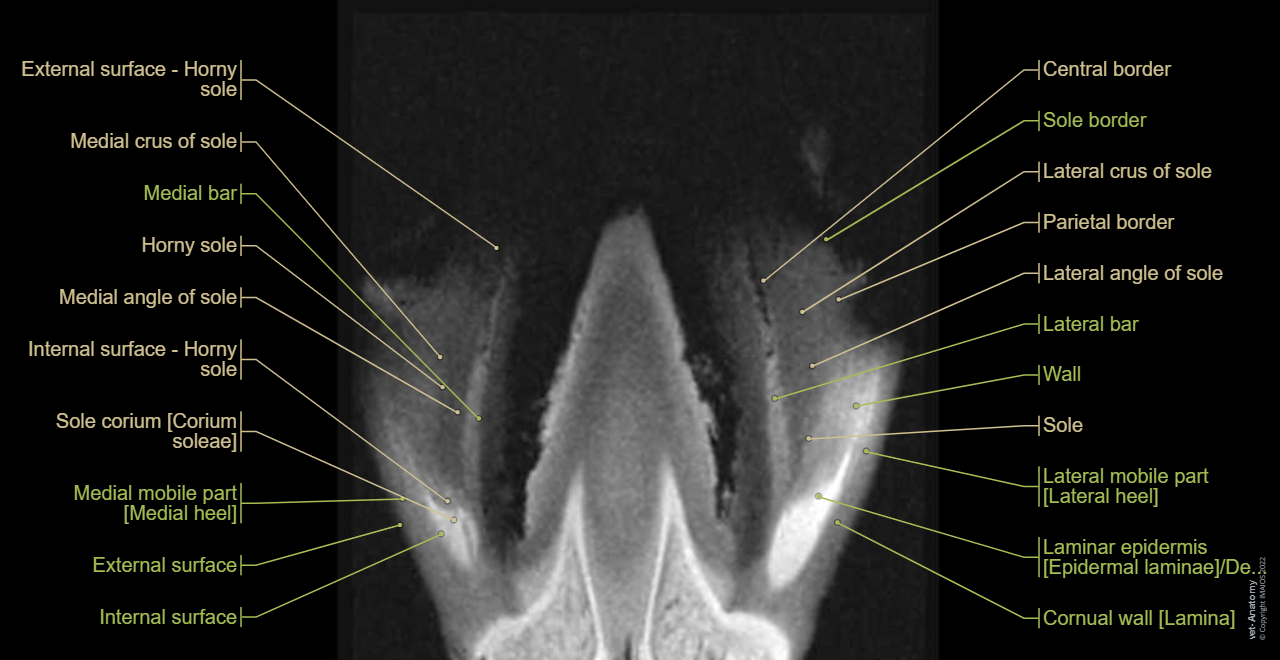 Foot and hoof anatomy of the horse on MRI (MRI - Flash-T1-FS-3D): Limbus, Corona of hoof [Coronet], Wall, Sole, Digital pad, Footpad, Frog, Hoof capsule, Digital cushion