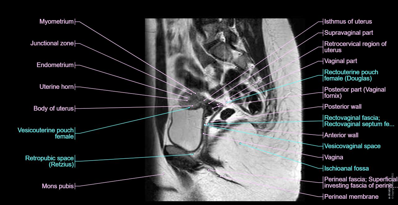 Sagittal slice of the female pelvis showing anatomical structures as genital organs (uterus, cervix, parametria, vagina, ovaries, adnexa), urinary system, muscles, arteries, veins, nerves and pelvic measurements.