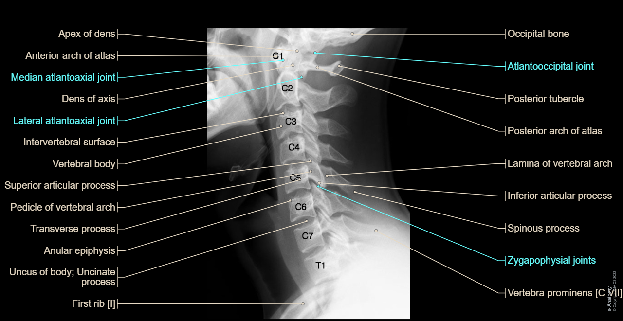 Spine - Cervical vertebrae [C I-C VII] - Radiographs : Atlas [C I], Axis [C II], Dens of axis