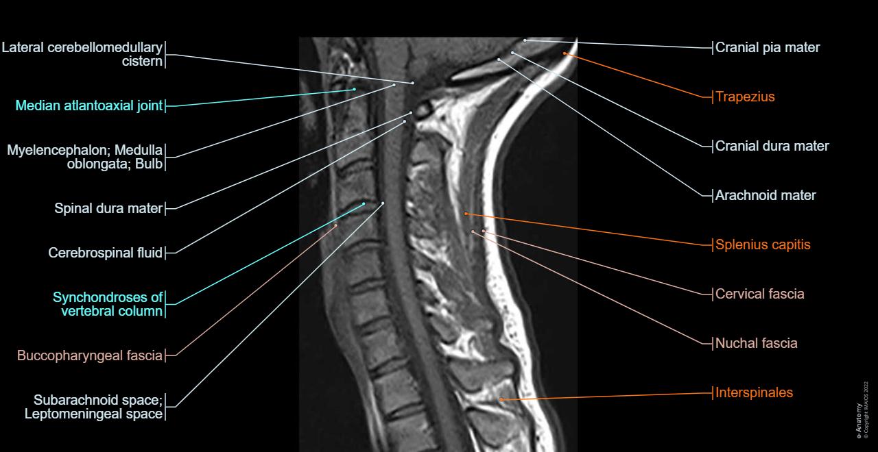 Cervical spine Sagittal T1